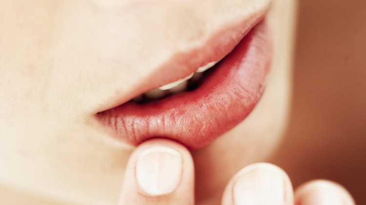 Was tun gegen spröde Lippen?